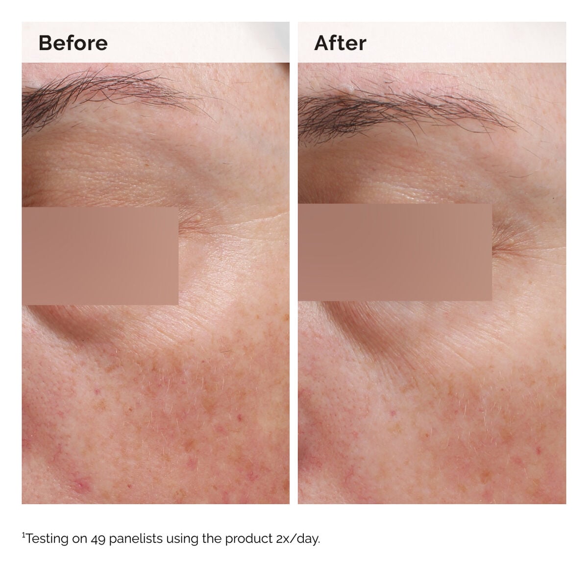 niacinamide-5-face-and-body-emulsion-m3 2024-08-23-ORD-Nia-5pct-Face-Body-B-A-Elasticity-Global-02-1x1.jpg
