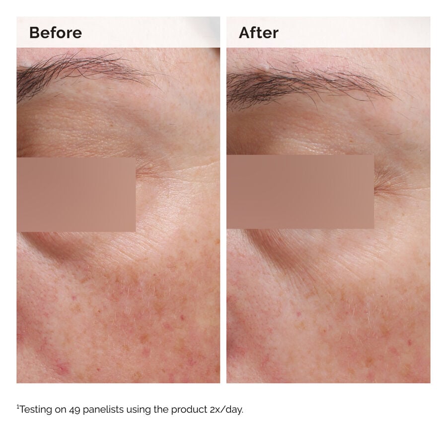 niacinamide-5-face-and-body-emulsion-m3 2024-08-23-ORD-Nia-5pct-Face-Body-B-A-Elasticity-Global-02-1x1.jpg