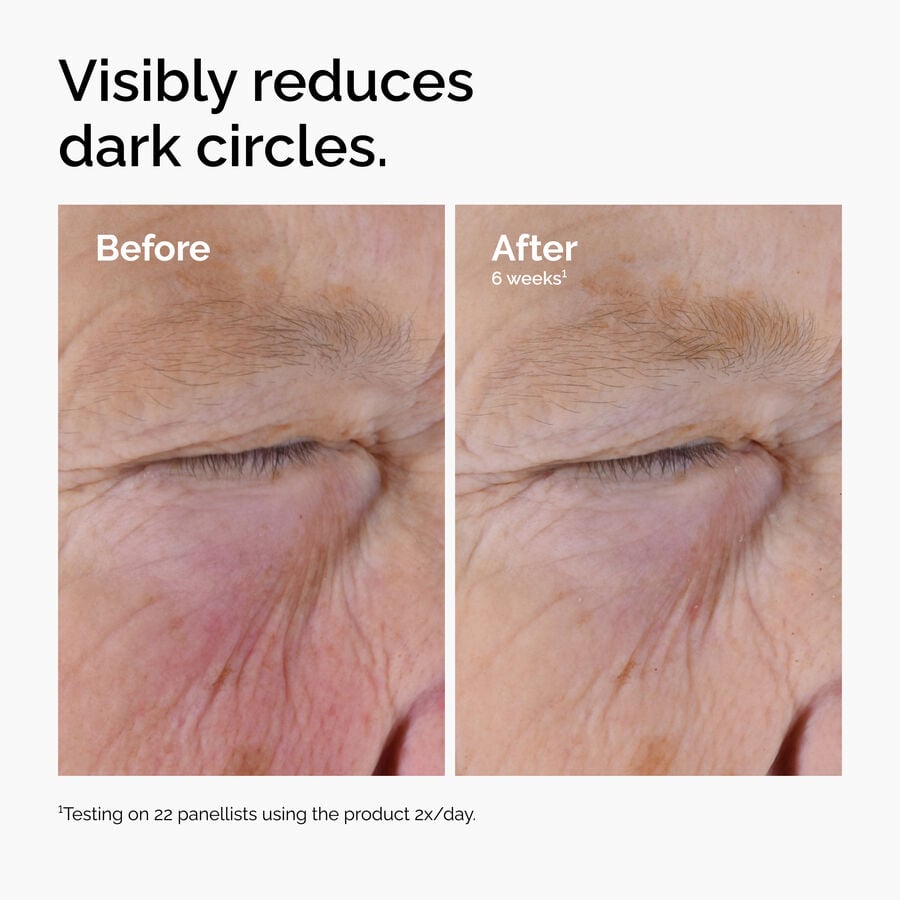 caffeine-solution-5-egcg-eye-serum-s2 ord-caffeine-solution-egcg-dark-circles-before-after.jpg