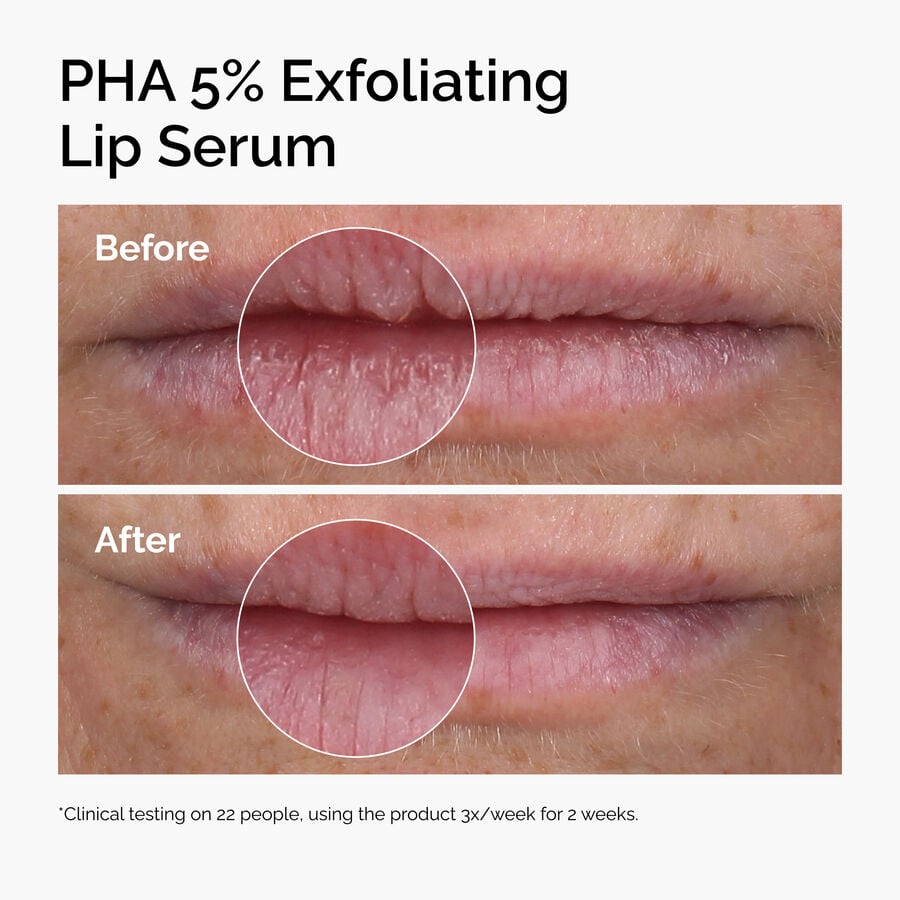 pha-5-exfoliating-lip-serum-c8 ord-pha-5pct-lip-exfoliating-serum-before-after.jpg