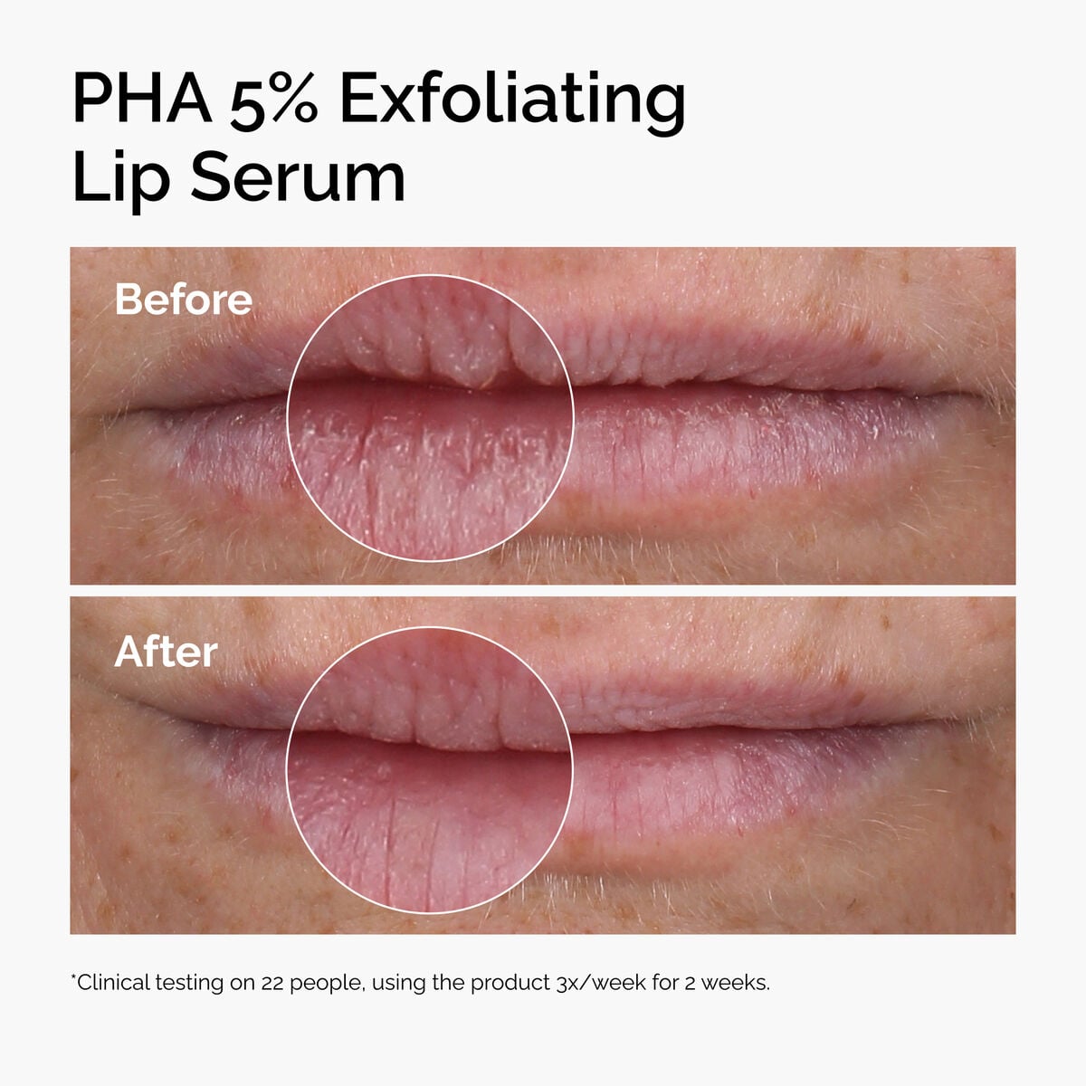 pha-5-exfoliating-lip-serum-c8 ord-pha-5pct-lip-exfoliating-serum-before-after.jpg