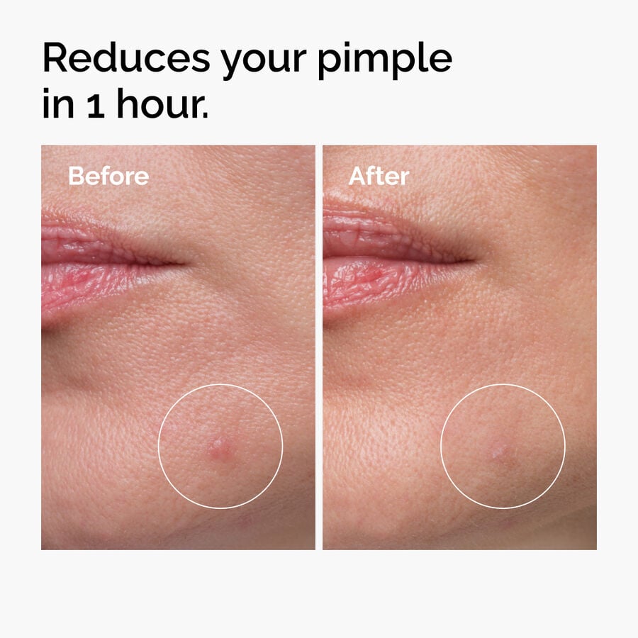 sulfur-10-powder-to-cream-concentrate-f3 ord-sulfur-10pct-powder-to-cream-concentrate-before-after-NA.jpg