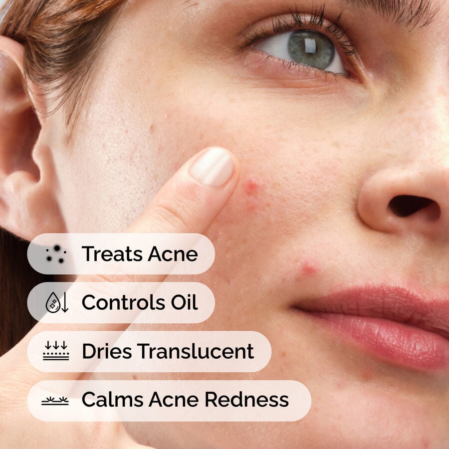 sulfur-10-powder-to-cream-concentrate-f3 ord-sulfur-10pct-powder-to-cream-concentrate-model-application-with-benefits-acne.jpg